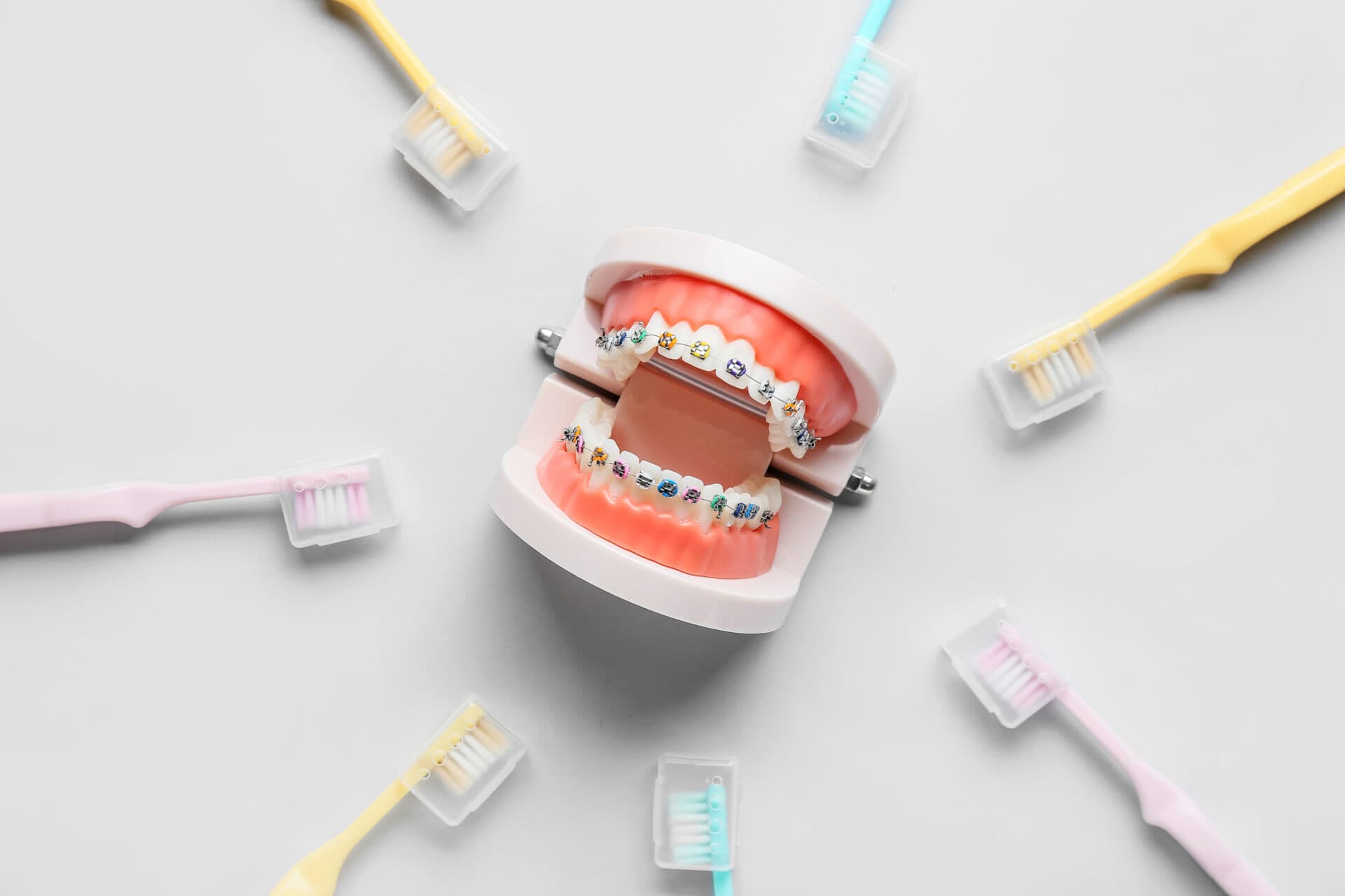 Model of jaw with dental braces and toothbrushes on light background