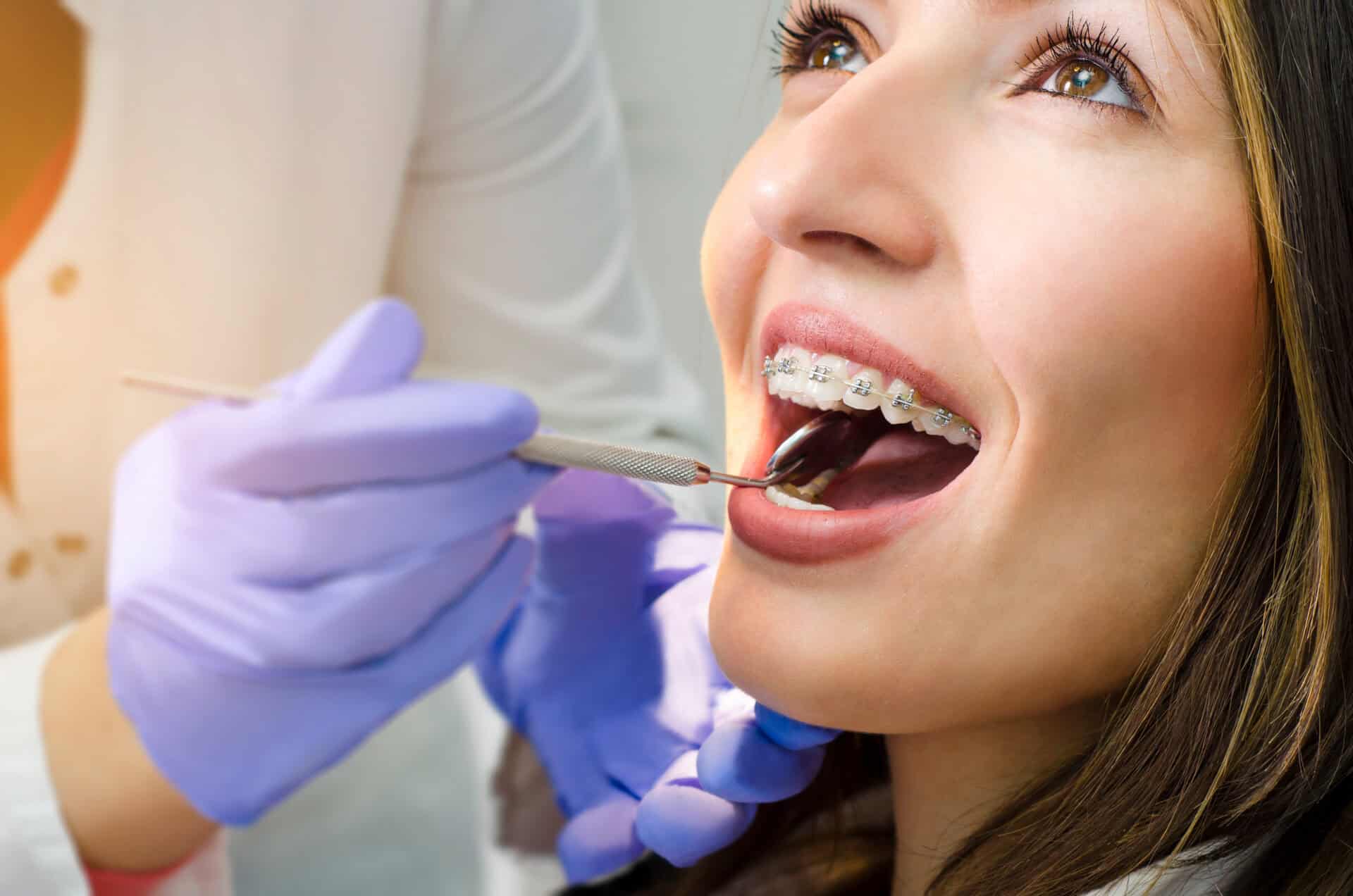 Closeup of beautiful girl on dental braces check up